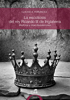 La escoliosis del rey Ricardo III de Inglaterra